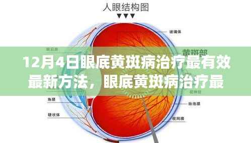眼底黄斑病治疗最新方法深度探讨与观点阐述,有效治疗策略分析