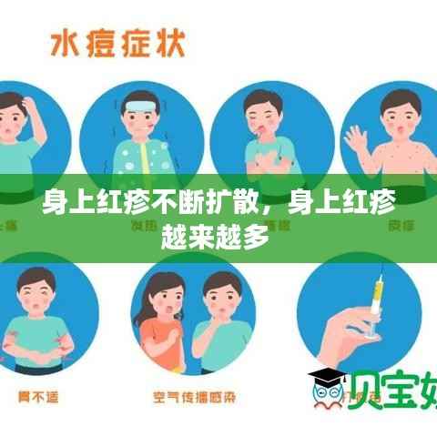 身上红疹不断扩散,身上红疹越来越多