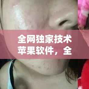 全网独家技术苹果软件,全网独家技术苹果软件怎么下载